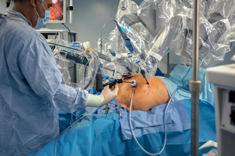 Robotic Gall Bladder Removal