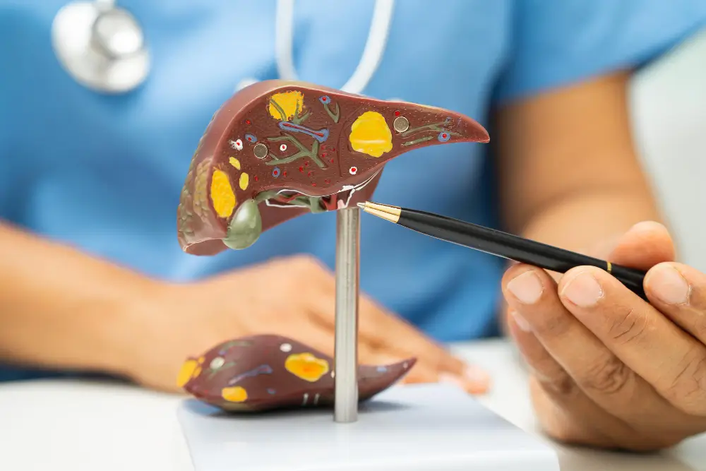 Fatty Liver Treatment