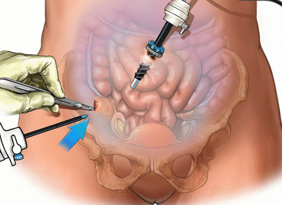 Best General Surgeons in Navi Mumbai